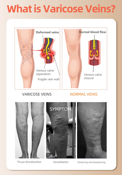 Humblise™ FlowEase Compression Socks